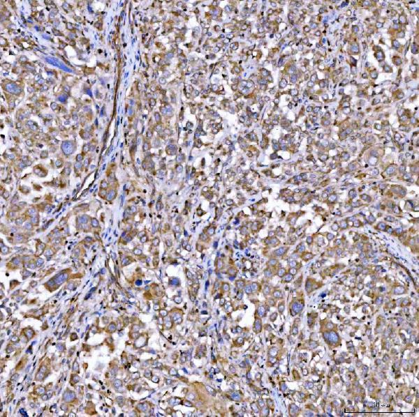 a04789 2 rab3gap1 primary antibodies ihc testing 5