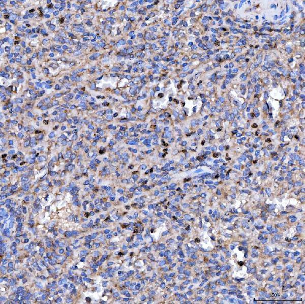 a04789 2 rab3gap1 primary antibodies ihc testing 6