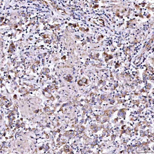 a04789 2 rab3gap1 primary antibodies ihc testing 7