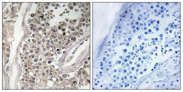 a04789 rab3gap1 primary antibodies ihc testing 1