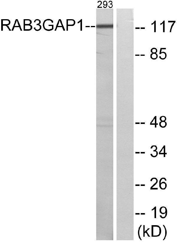 a04789 rab3gap1 primary antibodies wb testing 3