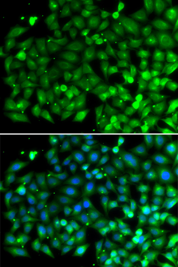 a04792 1 sh3glb1 primary antiboties if testing 1
