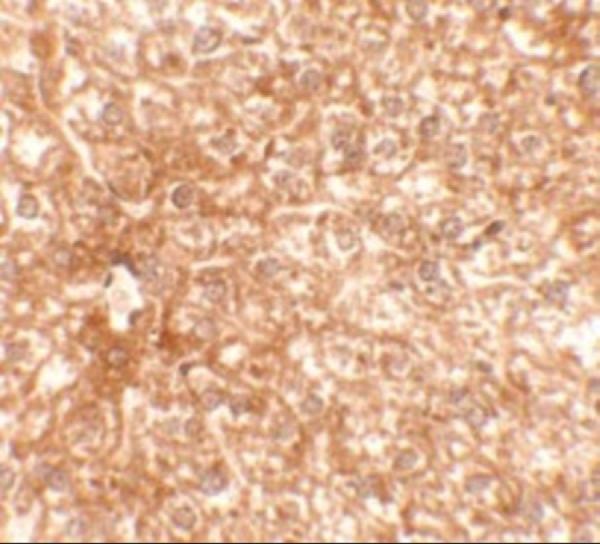 a04794 rapgef4 primary antibodies ihc testing 2