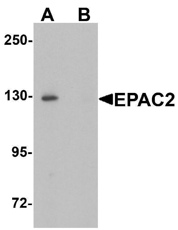 a04794 rapgef4 primary antibodies wb testing 1