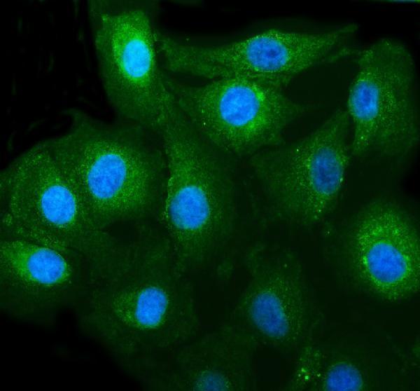 IF analysis of ADCY3 using anti-ADCY3 antibody (A04795)