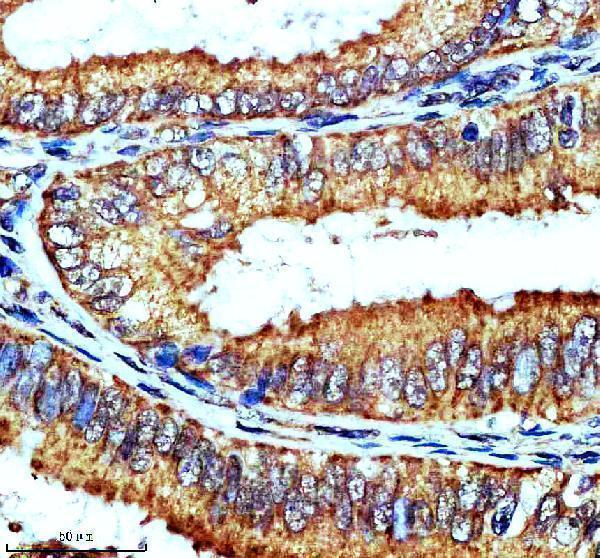 IHC analysis of ADCY3 using anti-ADCY3 antibody (A04795)