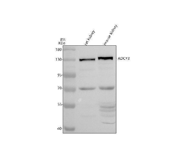 Western blot analysis of ADCY3 using anti-ADCY3 antibody (A04795)