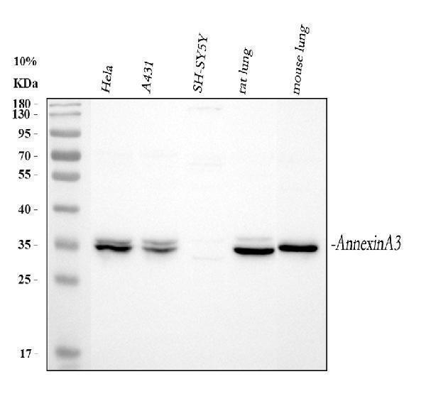  Western blot analysis of ANXA3 using anti-ANXA3 antibody (A04796)