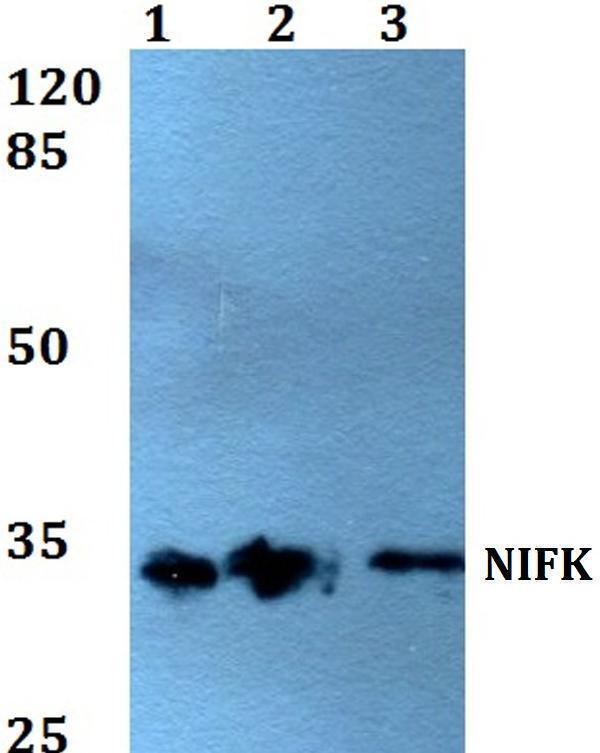 Western blot (WB) analysis of NIFK (D229) polyclonal antibody at 1:500 dilution
Lane1:A549 whole cell lysate
Lane2:Raw264