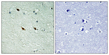 a04797t234 nifk primary antibodyes ihc testing 1