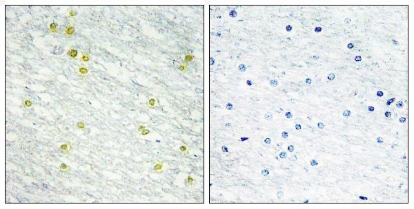 Immunohistochemistry analysis of paraffin-embedded human brain tissue, using MED14 Antibody