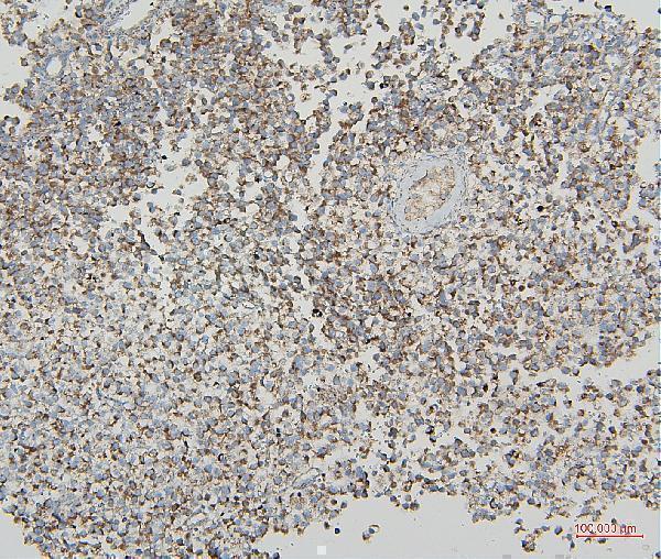 a04802 2 vdac3 primary antibodies ihc testing 2