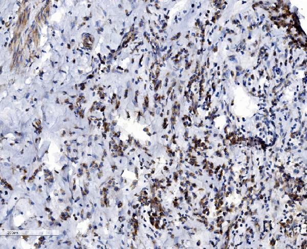 a04802 2 vdac3 primary antibodies ihc testing 3