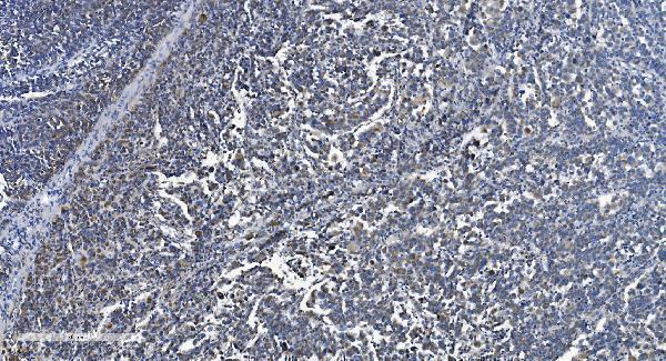 a04802 2 vdac3 primary antibodies ihc testing 4