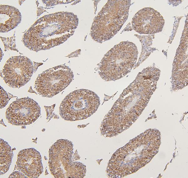 a04802 2 vdac3 primary antibodies ihc testing 5