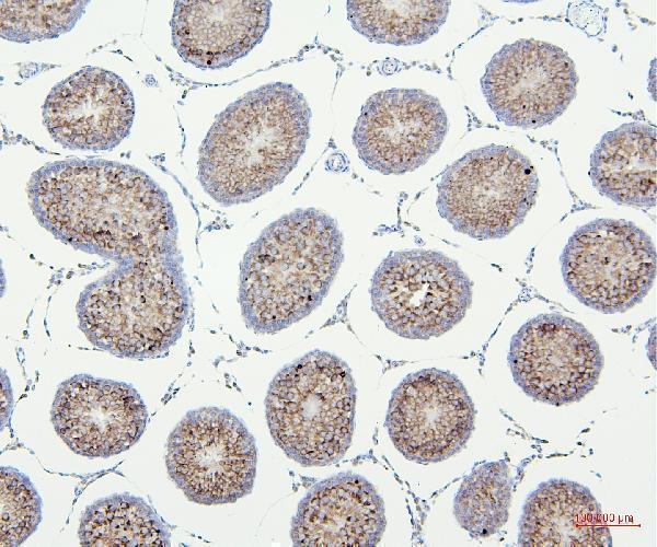 a04802 2 vdac3 primary antibodies ihc testing 6