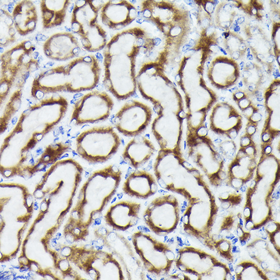 Immunohistochemistry of paraffin-embedded mouse kidney using VDAC3 Rabbit pAb  at dilution of 1:25 