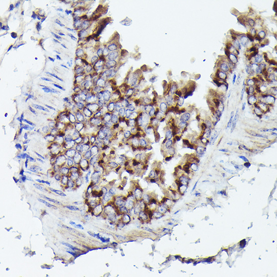 Immunohistochemistry of paraffin-embedded mouse lung using VDAC3 Rabbit pAb  at dilution of 1:25 
