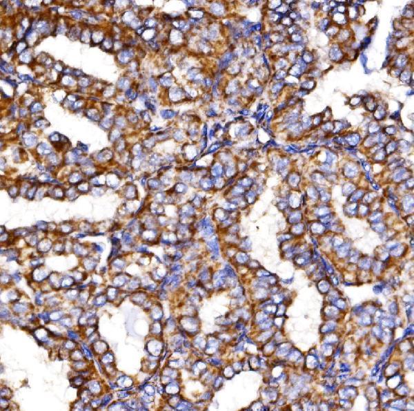 a04803 2 mdh2 primary antibodies ihc testing 3