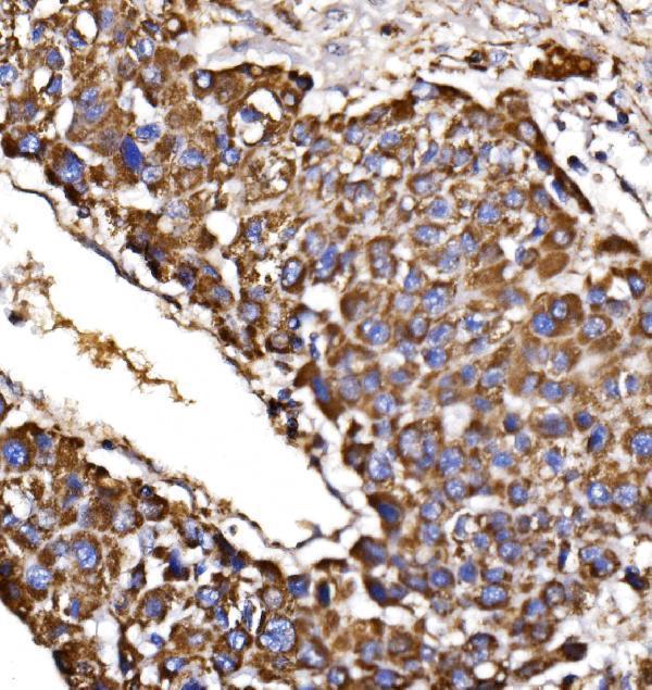 a04803 2 mdh2 primary antibodies ihc testing 5
