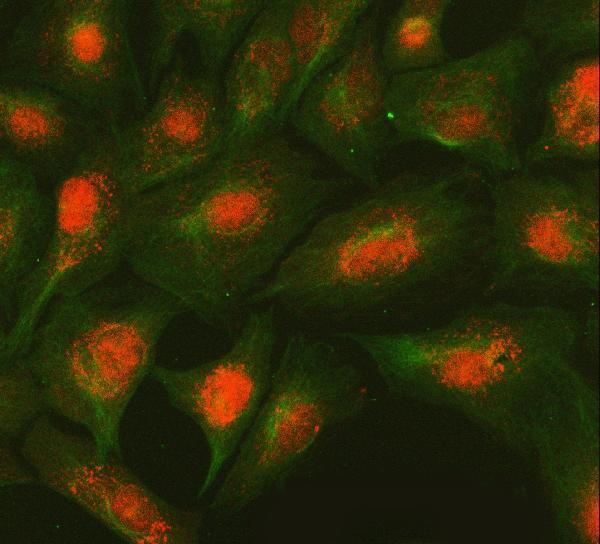  IF analysis of SMC2 and Tubulin beta using anti-SMC2 antibody (A04804-2) and anti-Tubulin beta antibody (M05613-4)