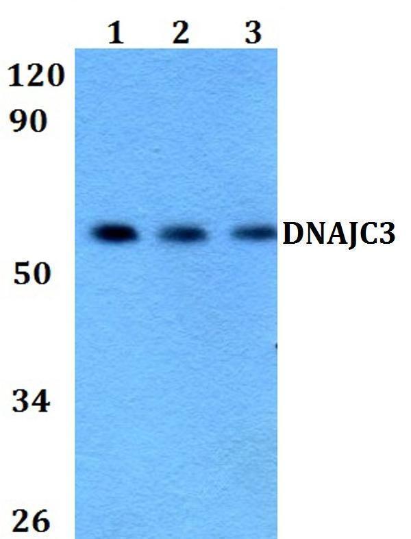 Western blot (WB) analysis of DNAJC3 polyclonal antibody at 1:500 dilution
Lane1:HEK293T whole cell lysate
Lane2:Raw264