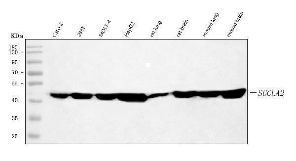  Western blot analysis of SUCLA2 using anti-SUCLA2 antibody (A04807-1)