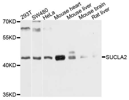 a04807 sucla2 primary antiboties wb testing 1