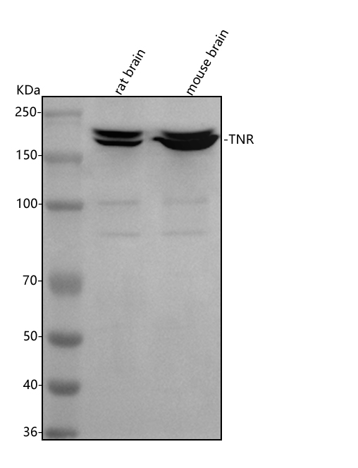  Western blot analysis of Tenascin-R/TNR using anti-Tenascin-R/TNR antibody (A04810-1)