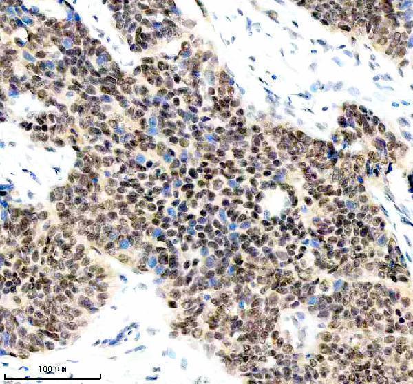  IHC analysis of LARP7 using anti-LARP7 antibody (A04811-1)
