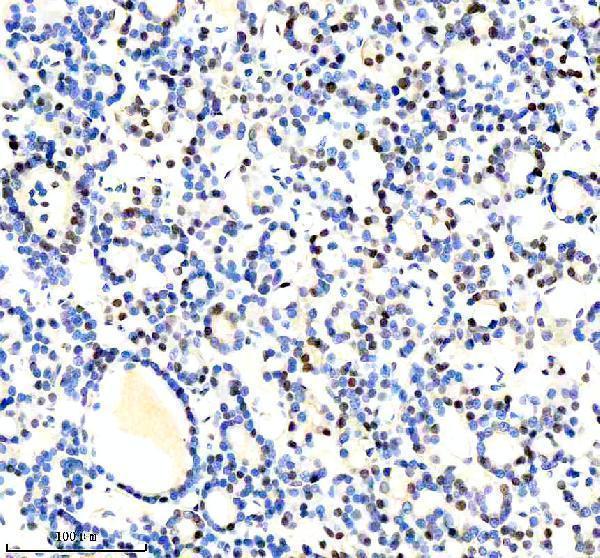  IHC analysis of LARP7 using anti-LARP7 antibody (A04811-1)