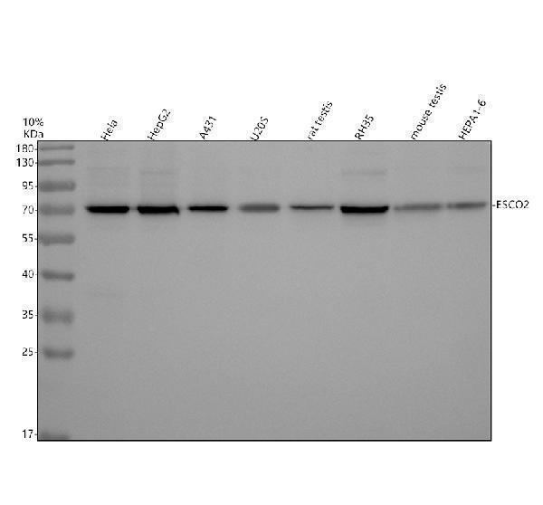Western blot analysis of ESCO2 using anti-ESCO2 antibody (A04812-1)