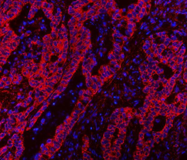 a04813 3 clasp1 primary antibodies if testing 7