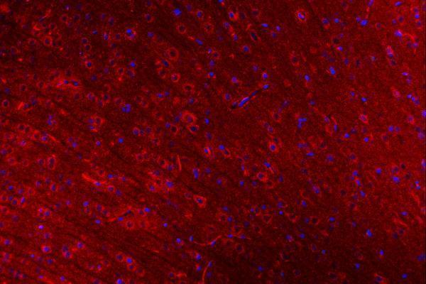 a04813 3 clasp1 primary antibodies if testing 8
