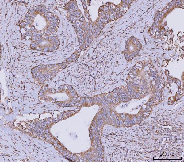  IHC analysis of CLASP1 using anti-CLASP1 antibody (A04813-3)