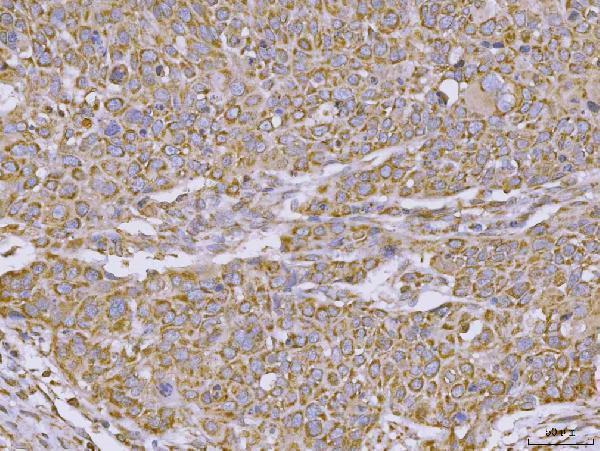  IHC analysis of CLASP1 using anti-CLASP1 antibody (A04813-3)