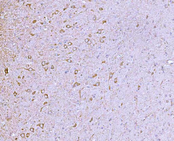 a04813 3 clasp1 primary antibodies ihc testing 6