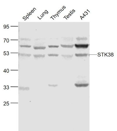 Primary: Anti-STK38 at 1/1000 dilution