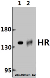 Western blot (WB) analysis of HR pAb at 1:500 dilution
Lane1:The Small intestine tissue lysate of Rat(40ug)
Lane2:A375 whole cell lysate(40ug)