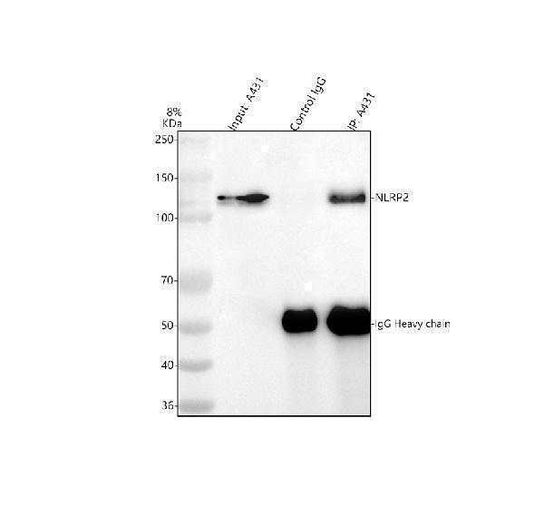 a04819 3 nlrp2 primary antibodies ip testing 4