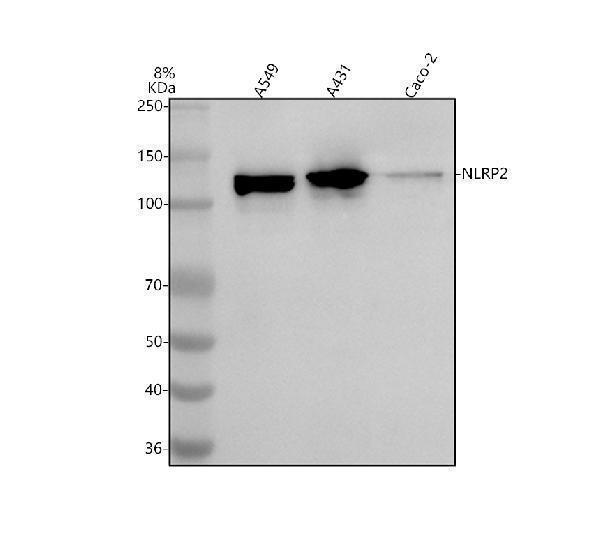  Western blot analysis of NLRP2 using anti-NLRP2 antibody (A04819-3)