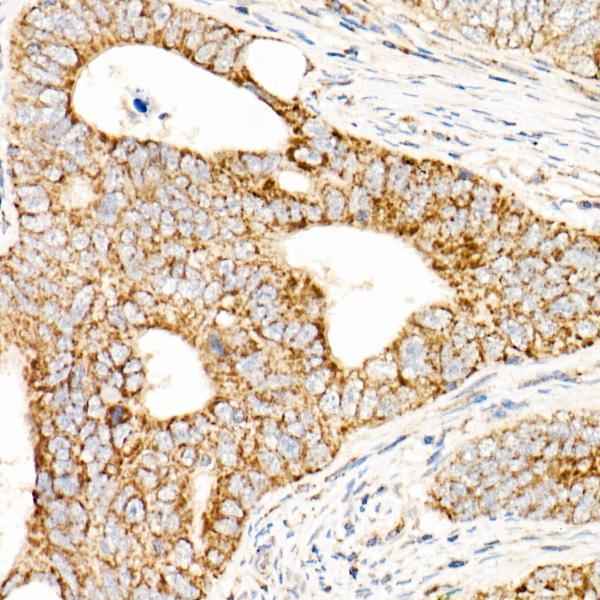 a04820 afg3l2 primary antiboties ihc testing 2