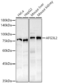 a04820 afg3l2 primary antiboties wb testing 1