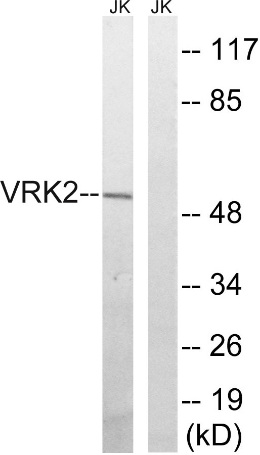 a04821 1 vrk2 primary antibodies wb testing 1