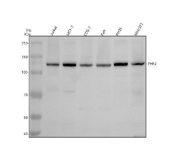 a04822 1 phf2 primary antibodies wb testing 1