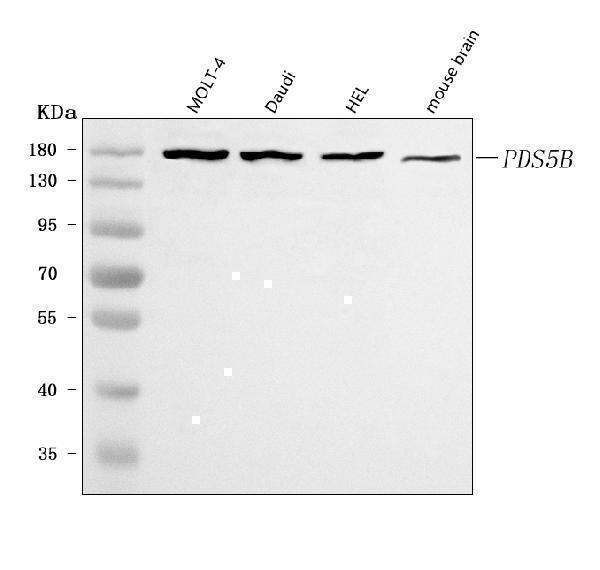  Western blot analysis of PDS5B using anti-PDS5B antibody (A04823-1)