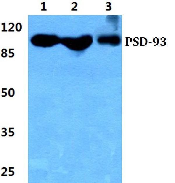 a04826 1 dlg2 primary antiboties wb testing 1