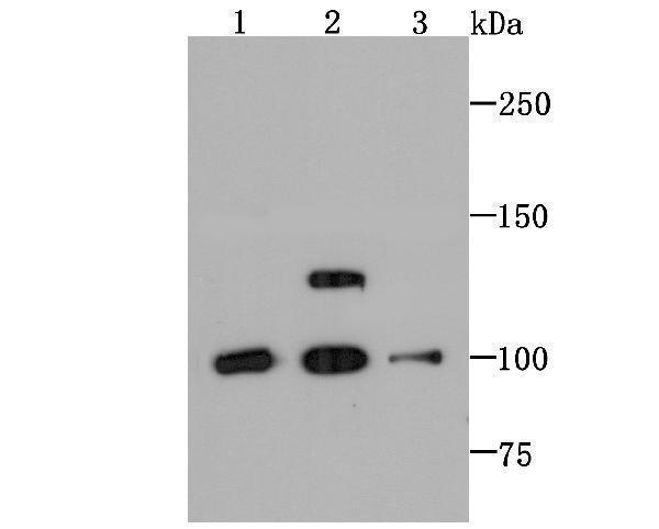 a04826 2 dlg2 primary antiboties wb testing 1