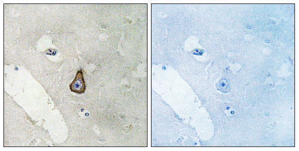 Immunohistochemistryt analysis of paraffin-embedded human brain, using DLG2 Antibody