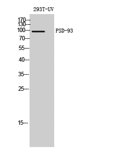 Western Blot analysis of 293T-UV cells using PSD-93 Polyclonal Antibody diluted at 1:1000